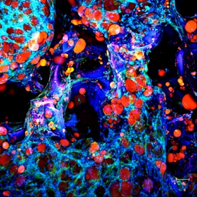 Image of adipose tissue in a silk scaffold.